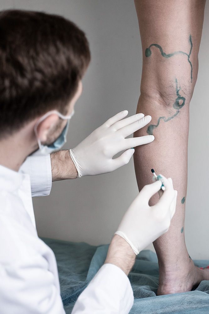 Dr. Nogueras varices