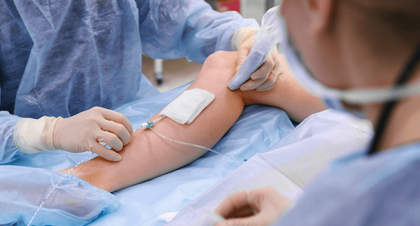 Cirugía de varices por radiofrecuencia